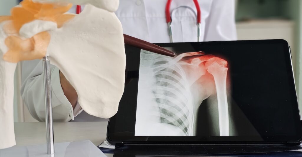 Injured shoulder